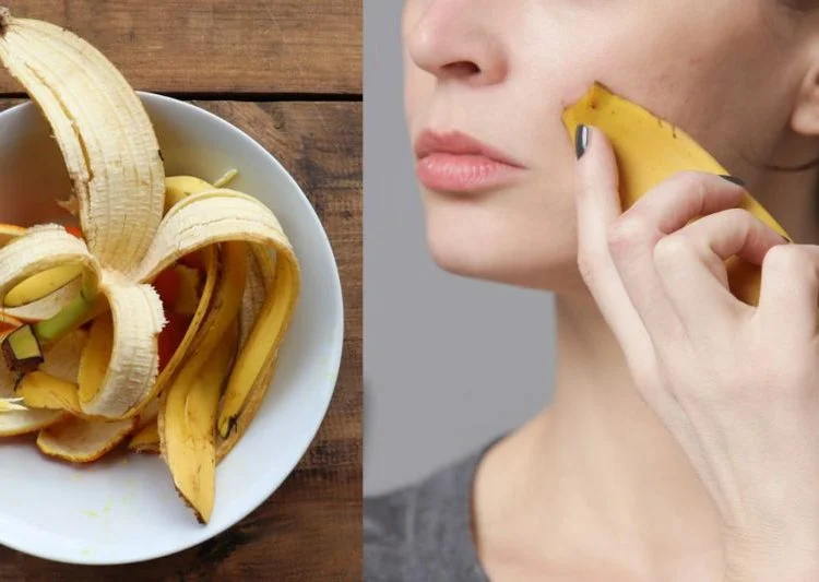 মুখের দাগ ও ব্রণ সারাবে কলার খোসা 1 banana 1 1024x533 1