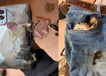 এবার প্যান্টের পকেটে বিস্ফোরিত হলো ওয়ানপ্লাসের ফোন 6 images 10