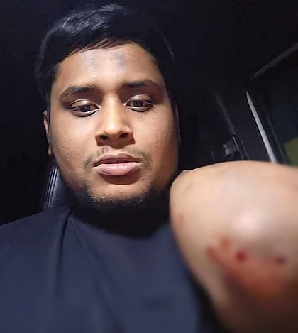 গাজীপুরে গাড়িতে হামলা, আহত হাসনাত আবদুল্লাহ 1 5F3AC2D5 172F 4410 9D2A BB7E061D8665