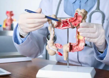 উপসর্গ দেখার আগেই শনাক্ত করা যাবে কোলন ক্যান্সার, কিভাবে সতর্ক হবেন 7 CEABC4F0 1EC4 4DA6 83A0 41462ECE396A