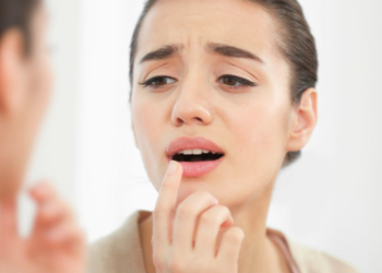 যে ভিটামিনের অভাবে ঠোঁট ফাটে 4 2DF9A4E0 192A 4957 A327 5CD589771B58