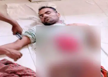 সীমান্তে বিএসএফের গুলিতে বাংলাদেশি যুবক আহত 5 003b3c10624fbe552921792eba9e869e 69bb708486c0c