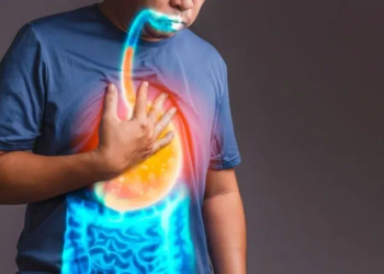 বুক জ্বালাপোড়া ও পেট ফাঁপলে করণীয় 2 news 1773715119350