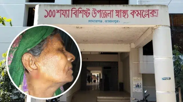ঘুমন্ত বৃদ্ধার কান ছিঁড়ে গয়না নিয়ে পালালো চোর 1 665b42fb76f3bb96d7c1f6c600d6a59e 69f32c8f7f11c